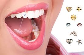 Women's Dental Jewellery